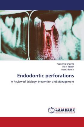 Endodontic perforations 