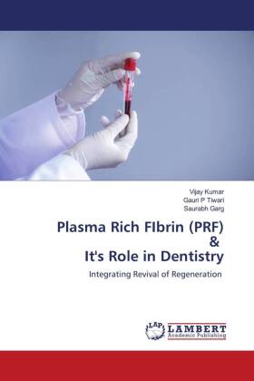 Plasma Rich FIbrin (PRF) & It's Role in Dentistry 