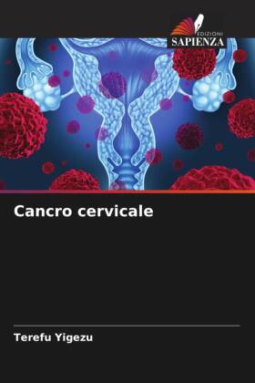Cancro cervicale 