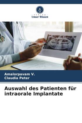 Auswahl des Patienten für intraorale Implantate 