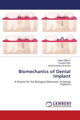 Biomechanics of Dental Implant 