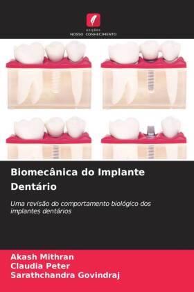 Biomecânica do Implante Dentário 