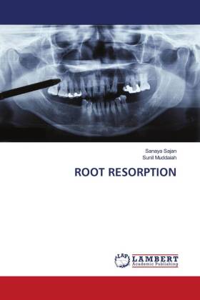 ROOT RESORPTION