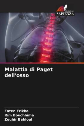 Malattia di Paget dell'osso