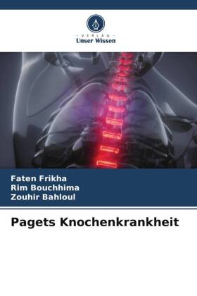 Pagets Knochenkrankheit