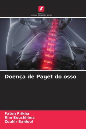 Doença de Paget do osso 