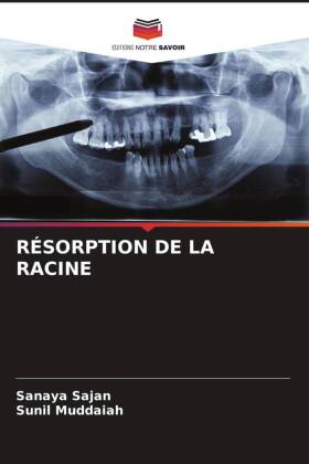 RÉSORPTION DE LA RACINE