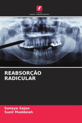 REABSORÇÃO RADICULAR