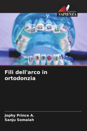 Fili dell'arco in ortodonzia