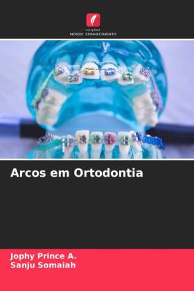 Arcos em Ortodontia
