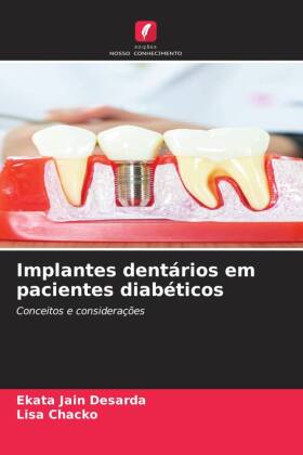 Implantes dentários em pacientes diabéticos