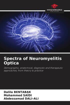 Spectra of Neuromyelitis Optica