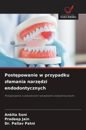 Postepowanie w przypadku zlamania narzedzi endodontycznych