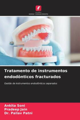 Tratamento de instrumentos endodônticos fracturados