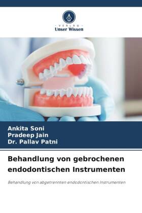 Behandlung von gebrochenen endodontischen Instrumenten